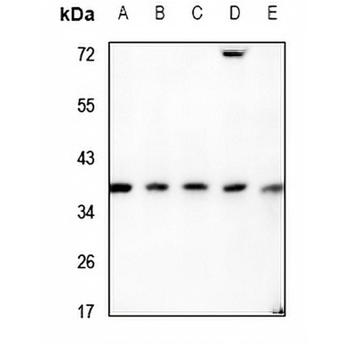 RNF113B Rabbit Polyclonal Antibody