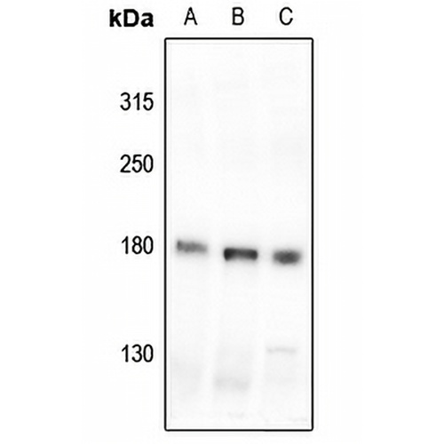 MYO3B Rabbit Polyclonal Antibody