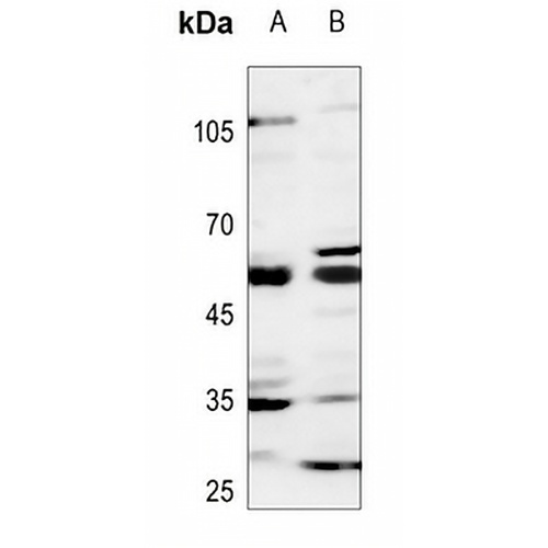 GCNT7 Rabbit Polyclonal Antibody