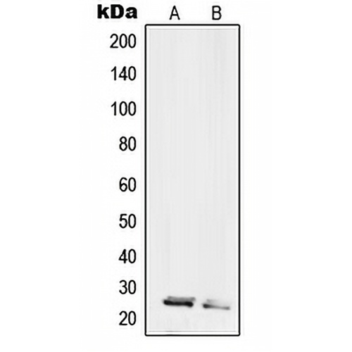 RPL10L Rabbit Polyclonal Antibody