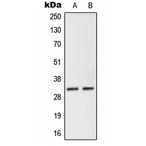 NEURL2 Rabbit Polyclonal Antibody