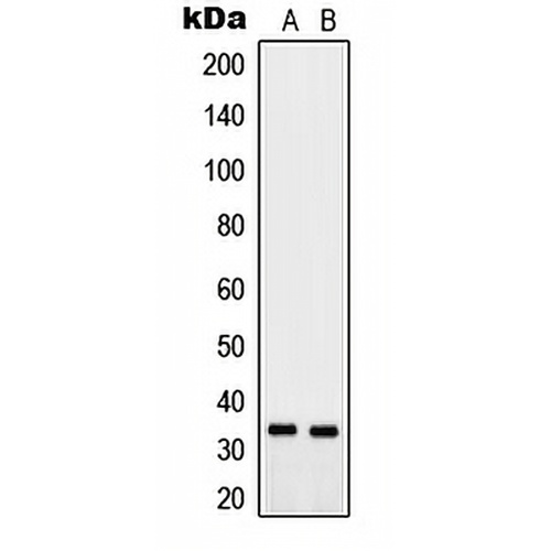 PTGR2 Rabbit Polyclonal Antibody