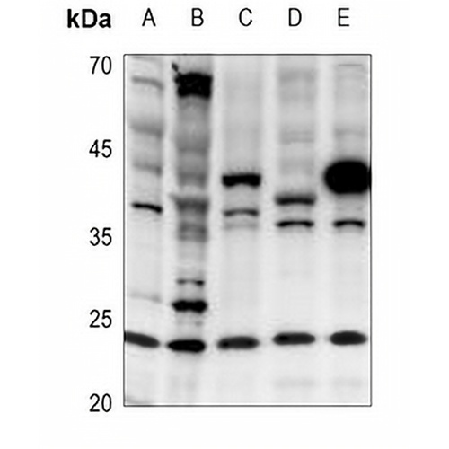 Cerebellin 2 Rabbit Polyclonal Antibody