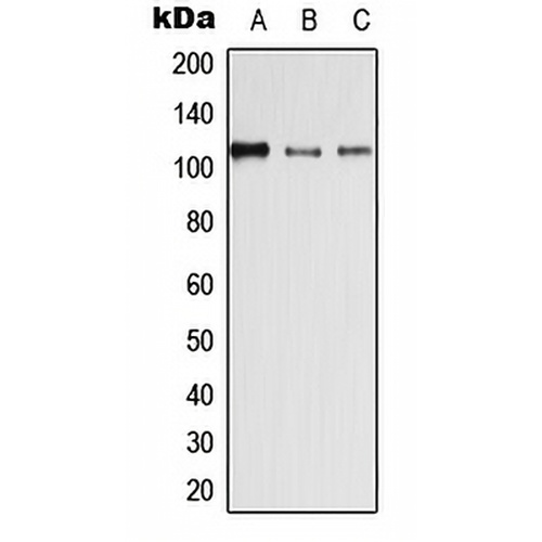Desmoglein 4 Rabbit Polyclonal Antibody