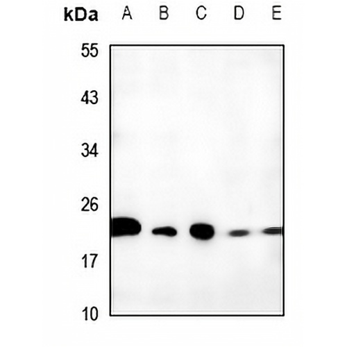 TCEAL6 Rabbit Polyclonal Antibody