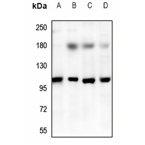 TRPV3 Rabbit Polyclonal Antibody