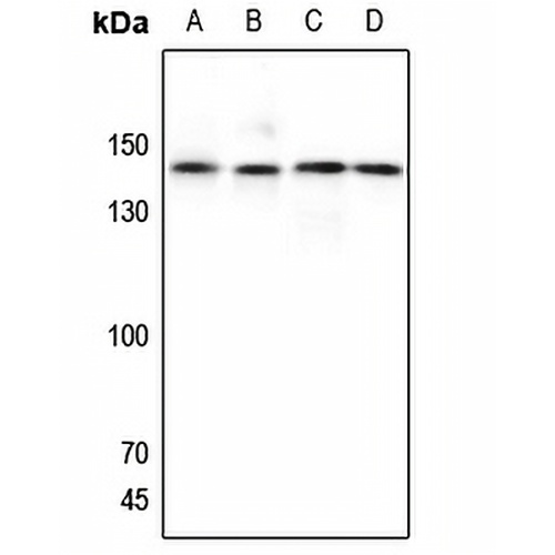 GPR125 Rabbit Polyclonal Antibody
