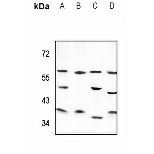 Cytochrome P450 4Z1/2 Rabbit Polyclonal Antibody