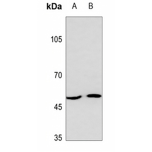 MCT13 Rabbit Polyclonal Antibody