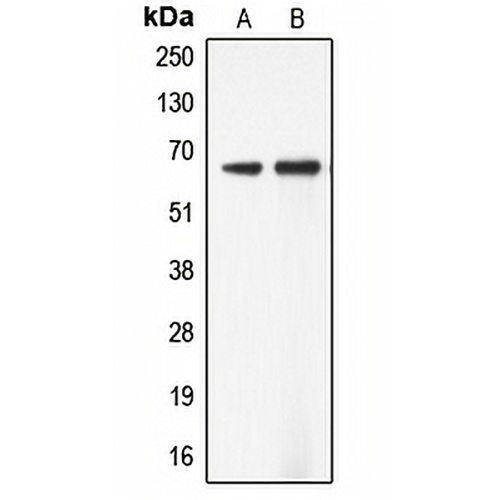 ADCK5 Rabbit Polyclonal Antibody