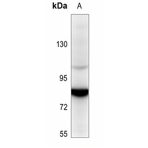 SENP5 Rabbit Polyclonal Antibody