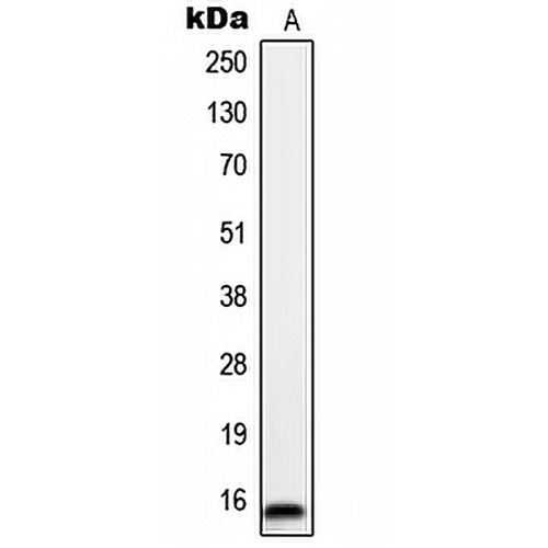 ORAOV1 Rabbit Polyclonal Antibody