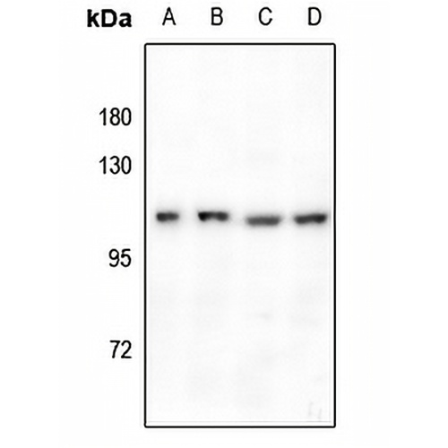 GPR110 Rabbit Polyclonal Antibody