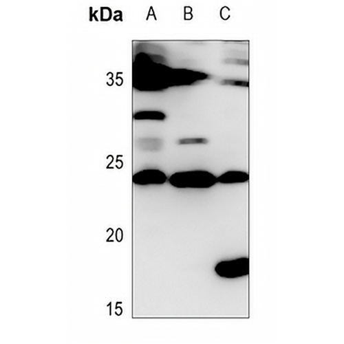 IL-28A Rabbit Polyclonal Antibody