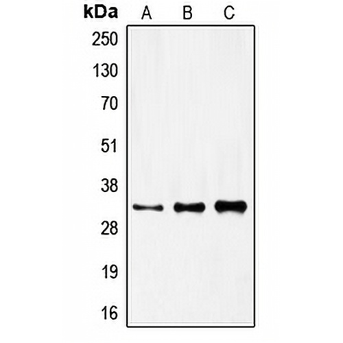 FOXR1 Rabbit Polyclonal Antibody