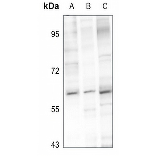 PIGW Rabbit Polyclonal Antibody