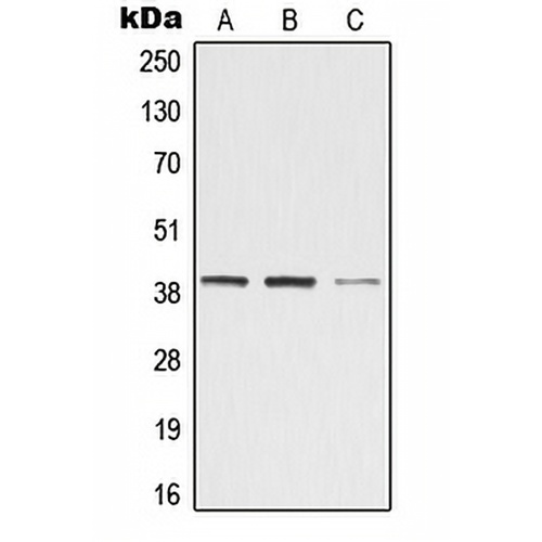 ZADH2 Rabbit Polyclonal Antibody