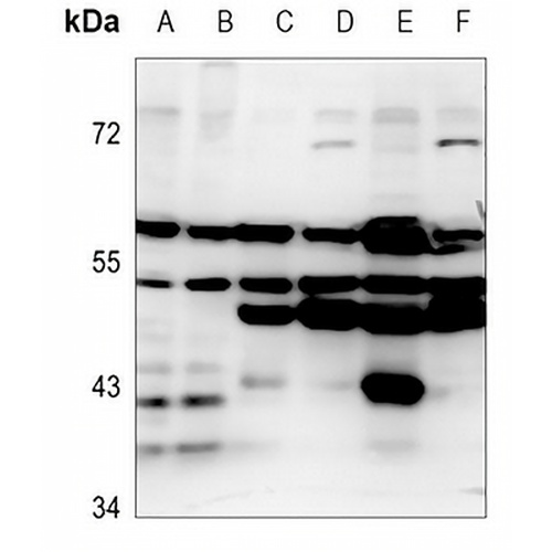 EMR4 Rabbit Polyclonal Antibody