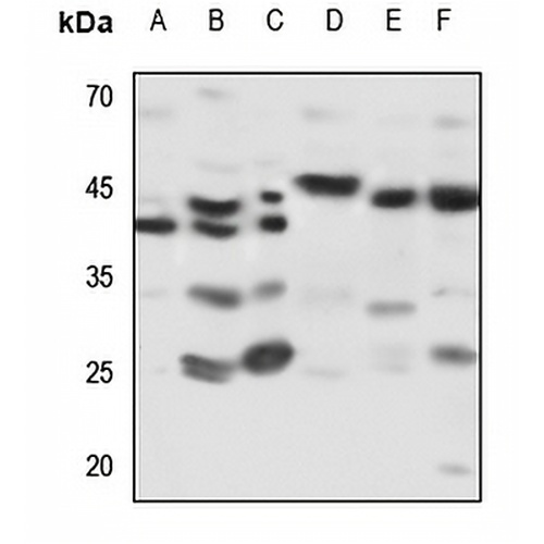 Kappa-actin Rabbit Polyclonal Antibody