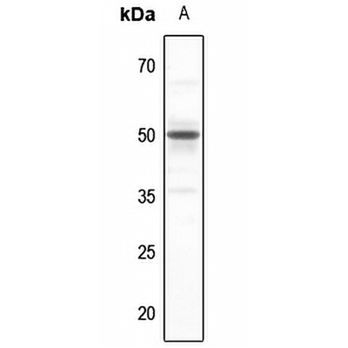 SERINC2 Rabbit Polyclonal Antibody
