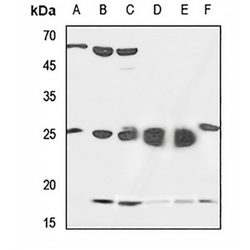 SFT2D2 Rabbit Polyclonal Antibody