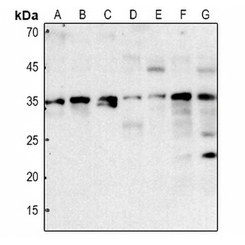 Aquaporin 12A Rabbit Polyclonal Antibody