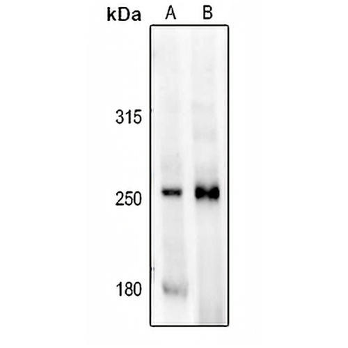 MAST4 Rabbit Polyclonal Antibody