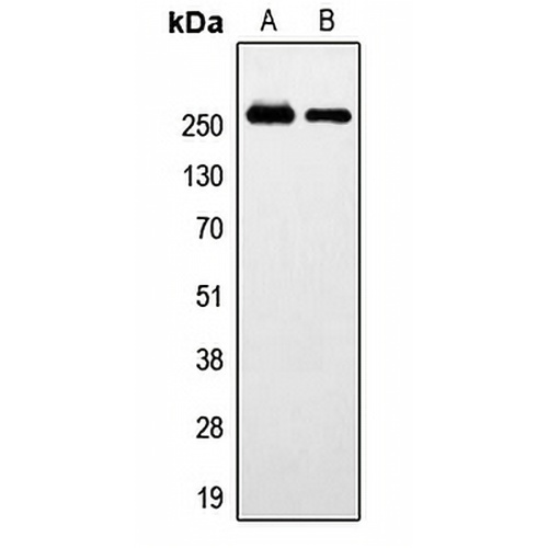 GPR179 Rabbit Polyclonal Antibody