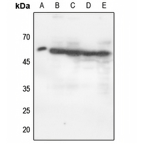 p47 phox (Phospho-S370) Rabbit Polyclonal Antibody