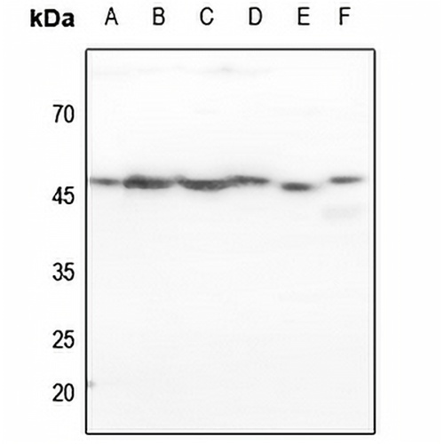 p47 phox Rabbit Polyclonal Antibody