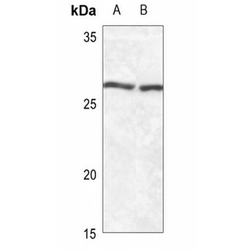 SFTPA1/2 Rabbit Polyclonal Antibody