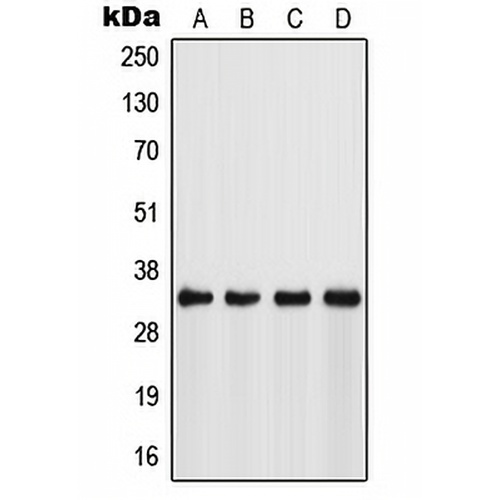 FSBP Rabbit Polyclonal Antibody
