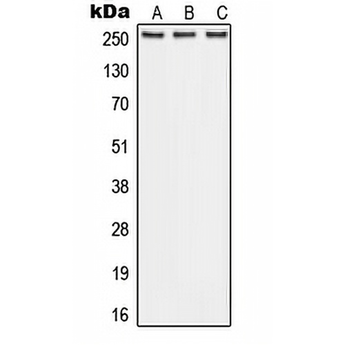 ABCA1 Rabbit Polyclonal Antibody