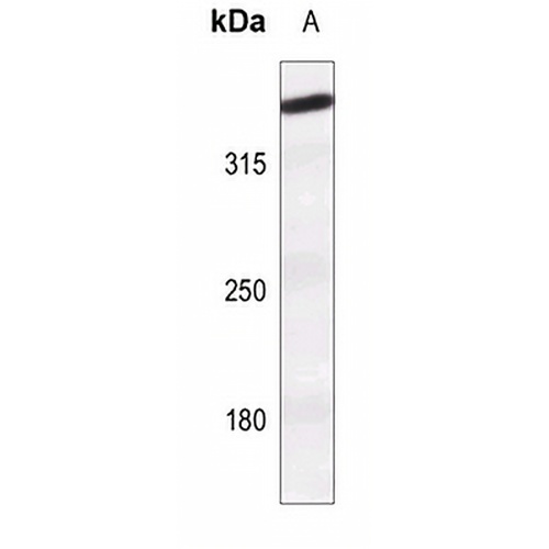 ATM (Phospho-S1981) Rabbit Polyclonal Antibody
