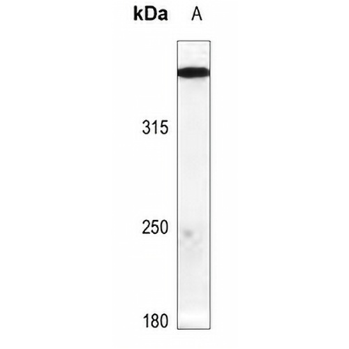 ATM (Phospho-S1987) Rabbit Polyclonal Antibody
