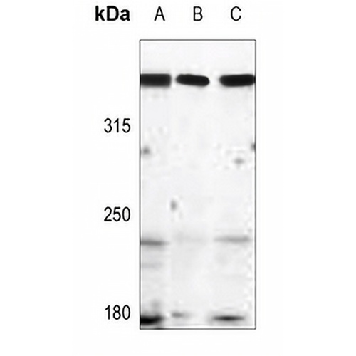 ATM Rabbit Polyclonal Antibody