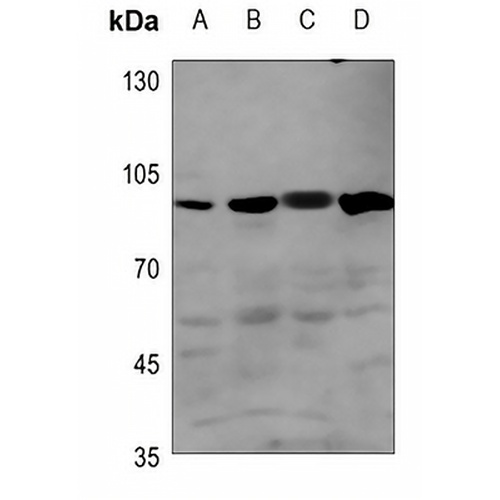BMPR2 Rabbit Polyclonal Antibody