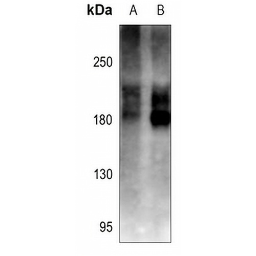 Cav1.2 Rabbit Polyclonal Antibody