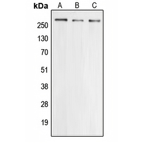 Cav2.3 Rabbit Polyclonal Antibody