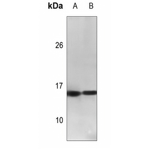 Calcitonin Rabbit Polyclonal Antibody