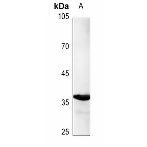 C/EBP alpha (Phospho-S193) Rabbit Polyclonal Antibody