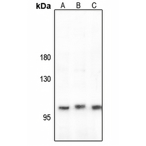 CLCN1 Rabbit Polyclonal Antibody