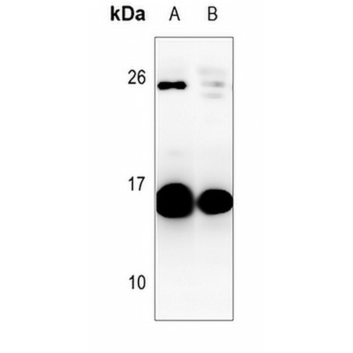 GM-CSF Rabbit Polyclonal Antibody