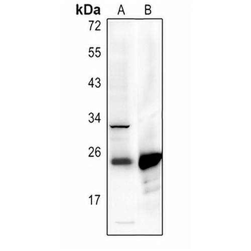 p22 phox Rabbit Polyclonal Antibody