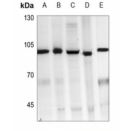CD105 Rabbit Polyclonal Antibody