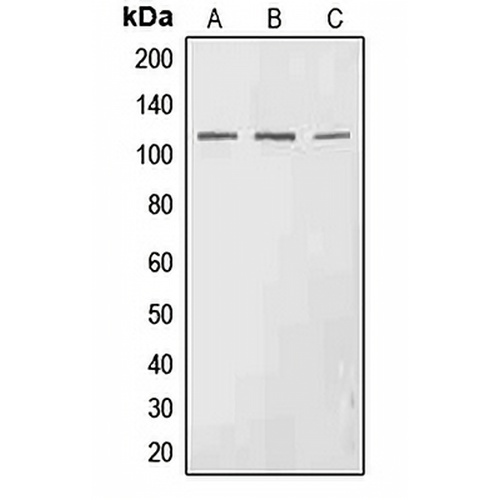 EPHA3 (Phospho-Y602) Rabbit Polyclonal Antibody