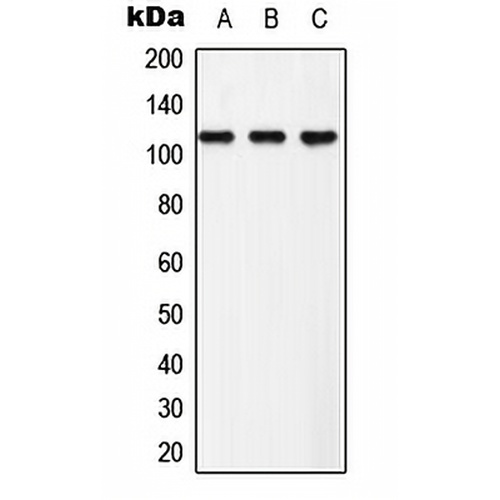 EPHB3 (Phospho-Y608) Rabbit Polyclonal Antibody