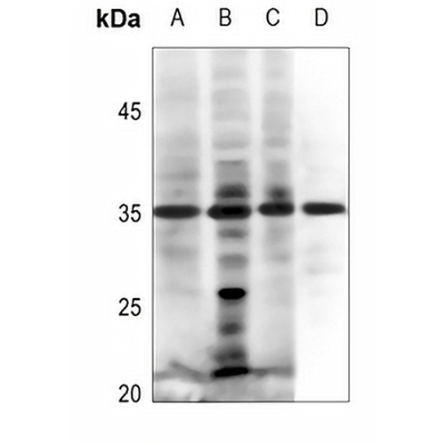 EPO Rabbit Polyclonal Antibody