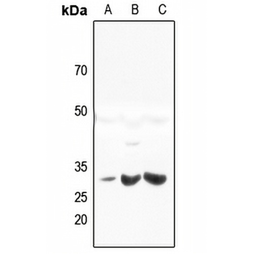 HLA-DQB2 Rabbit Polyclonal Antibody