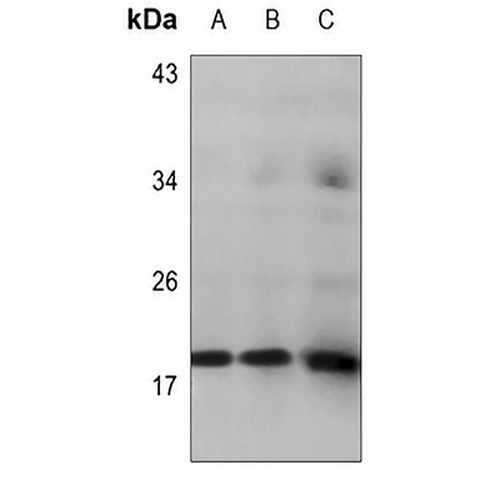 HMGA1 Rabbit Polyclonal Antibody